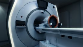 INSIGHTEC® riceve l'approvazione della FDA per la neuro compatibilità con la MRI dei siemens healthineers